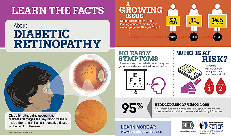 diabetic-retinopathy-screening-eyenuk-inc-artificial-intelligence