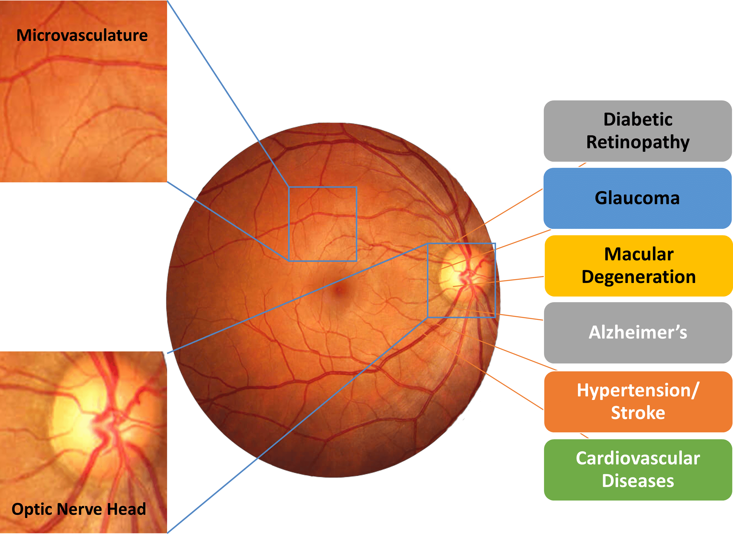 Retina_And_Diseases_2 Retina_And_Diseases_2